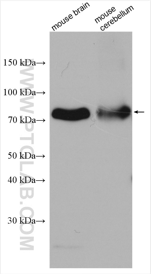 Western Blot (WB) analysis of various lysates using P2RX7 Polyclonal antibody (28207-1-AP)