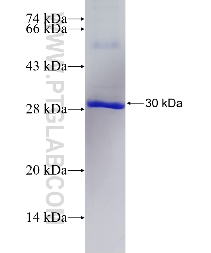 P2RX7 fusion protein Ag27700 SDS-PAGE