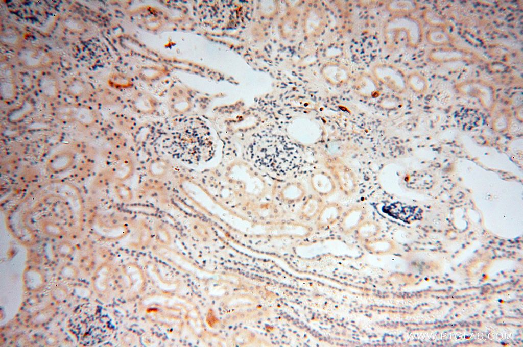 Immunohistochemistry (IHC) staining of human kidney tissue using P2RY1 Polyclonal antibody (18273-1-AP)