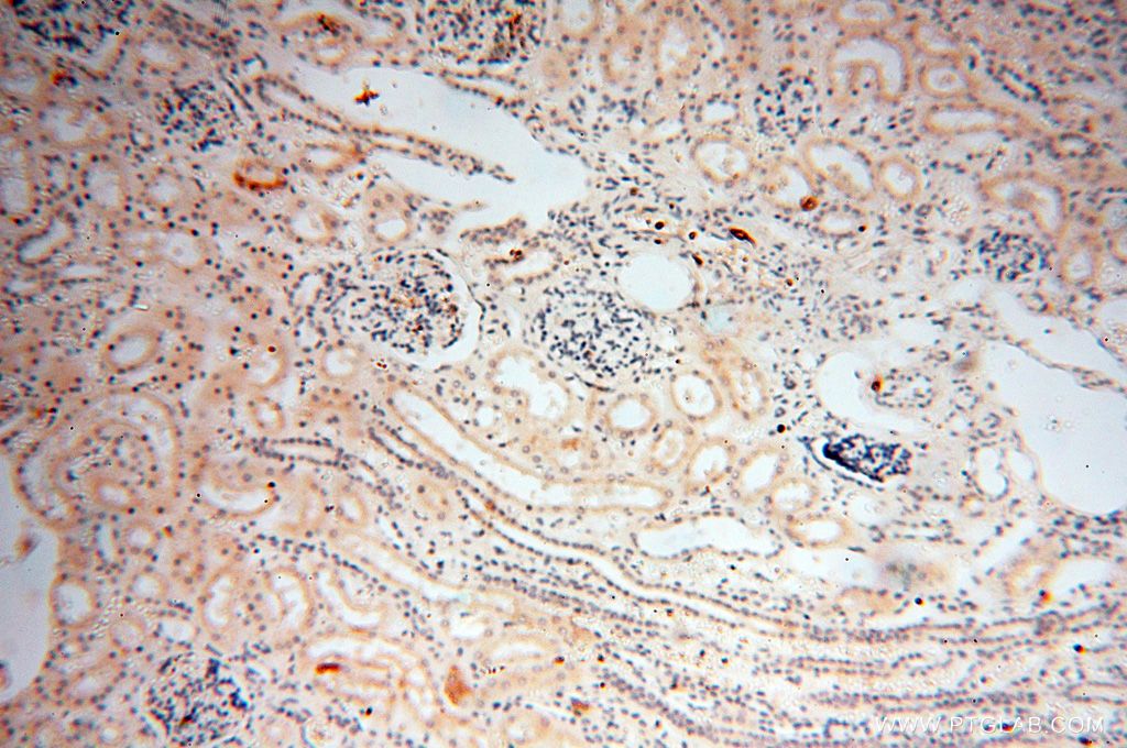 IHC staining of human kidney using 18273-1-AP