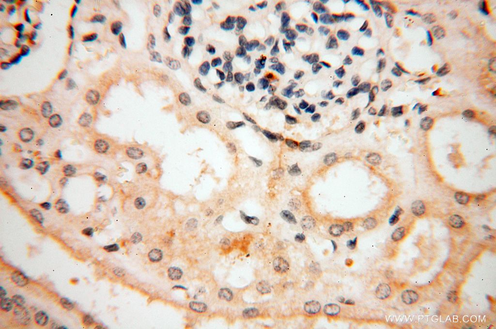 Immunohistochemistry (IHC) staining of human kidney tissue using P2RY1 Polyclonal antibody (18273-1-AP)