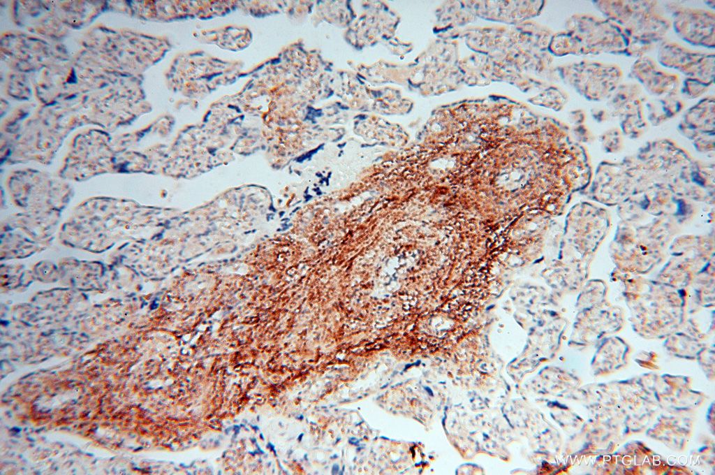 Immunohistochemistry (IHC) staining of human placenta tissue using P2RY1 Polyclonal antibody (18273-1-AP)