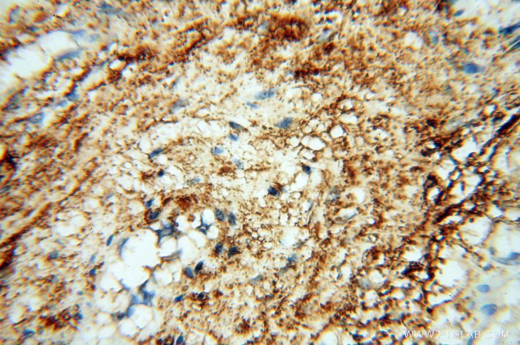 Immunohistochemistry (IHC) staining of human placenta tissue using P2RY1 Polyclonal antibody (18273-1-AP)