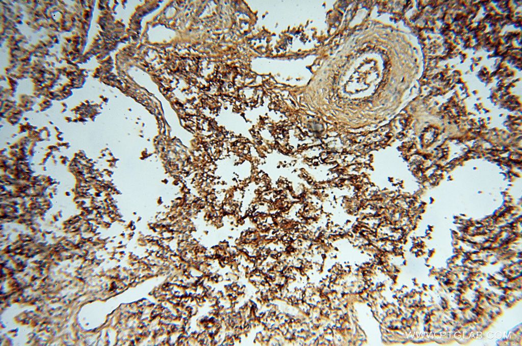 Immunohistochemistry (IHC) staining of human lung tissue using P2RY1 Polyclonal antibody (18273-1-AP)