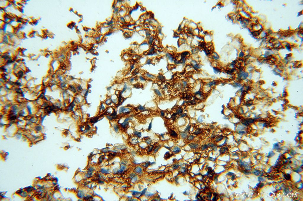 Immunohistochemistry (IHC) staining of human lung tissue using P2RY1 Polyclonal antibody (18273-1-AP)