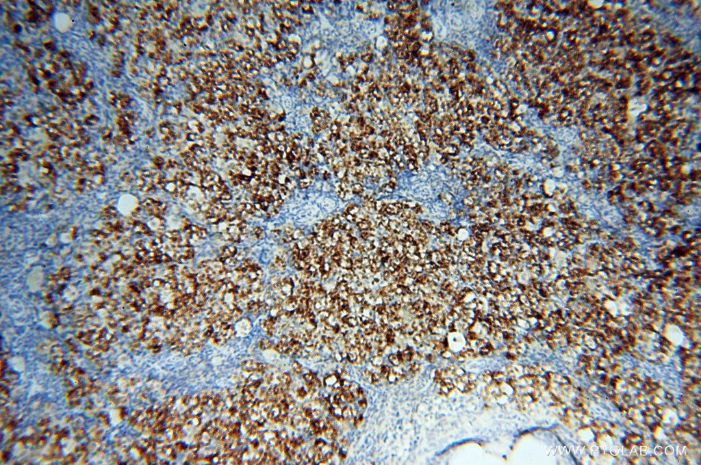 Immunohistochemistry (IHC) staining of human ovary tissue using P2RY1 Polyclonal antibody (18273-1-AP)