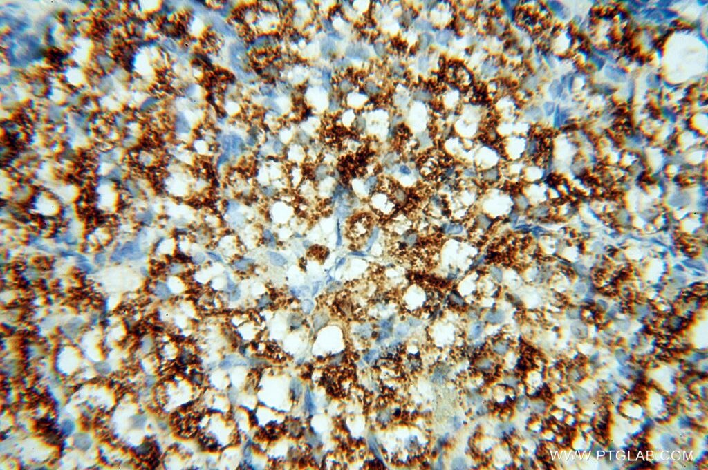 Immunohistochemistry (IHC) staining of human ovary tissue using P2RY1 Polyclonal antibody (18273-1-AP)