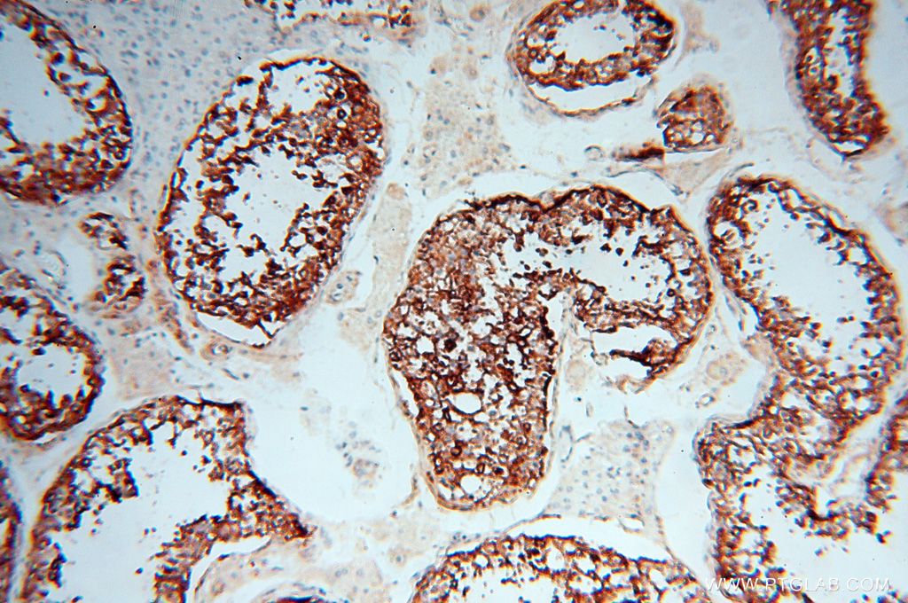 Immunohistochemistry (IHC) staining of human testis tissue using P2RY1 Polyclonal antibody (18273-1-AP)