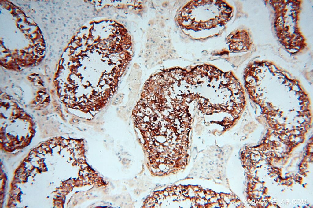 IHC staining of human testis using 18273-1-AP