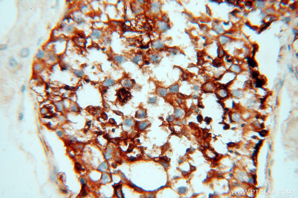 Immunohistochemistry (IHC) staining of human testis tissue using P2RY1 Polyclonal antibody (18273-1-AP)