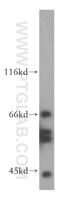 Western Blot (WB) analysis of Jurkat cells using P2RY1 Polyclonal antibody (18273-1-AP)