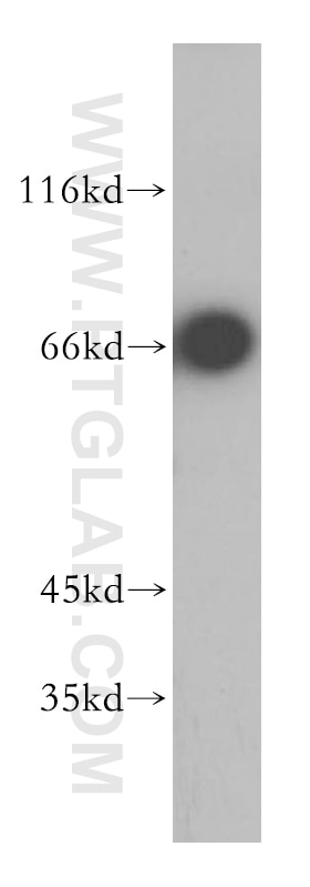Western Blot (WB) analysis of mouse heart tissue using P2RY1 Polyclonal antibody (18273-1-AP)