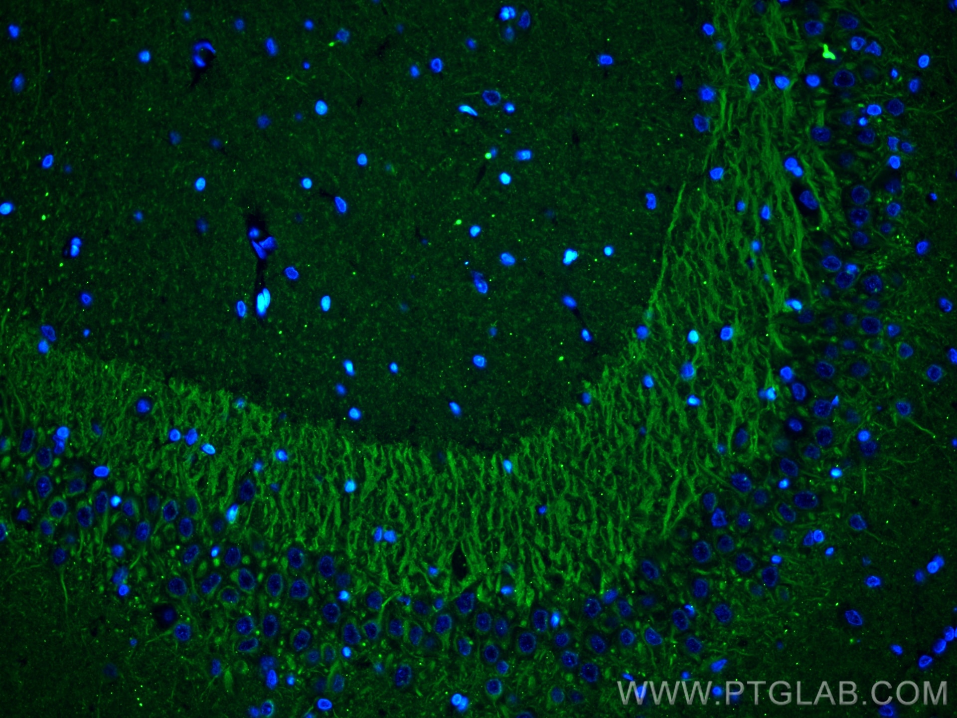 Immunofluorescence (IF) / fluorescent staining of rat brain tissue using P2RY1 Monoclonal antibody (67654-1-Ig)