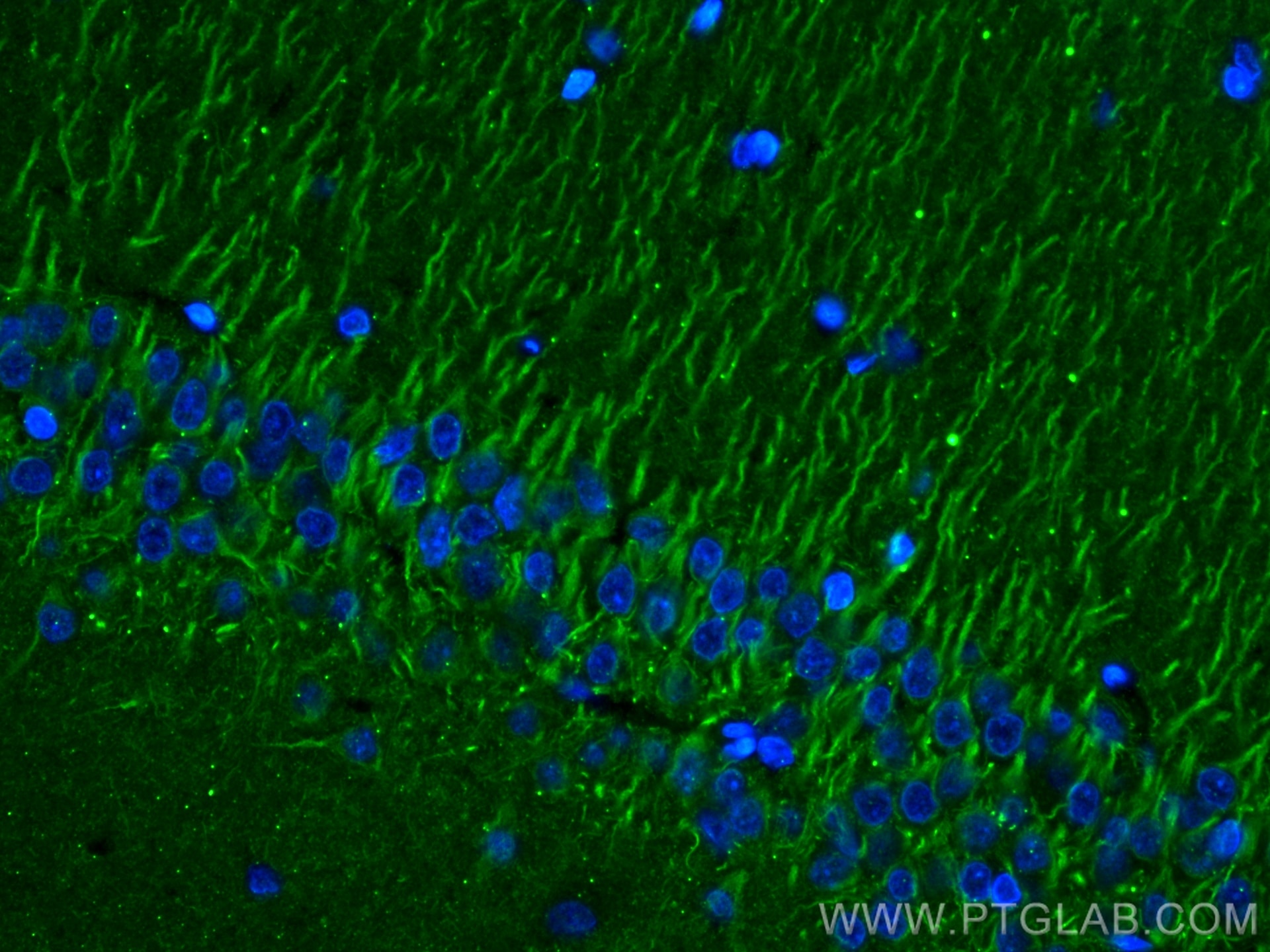 Immunofluorescence (IF) / fluorescent staining of rat brain tissue using P2RY1 Monoclonal antibody (67654-1-Ig)