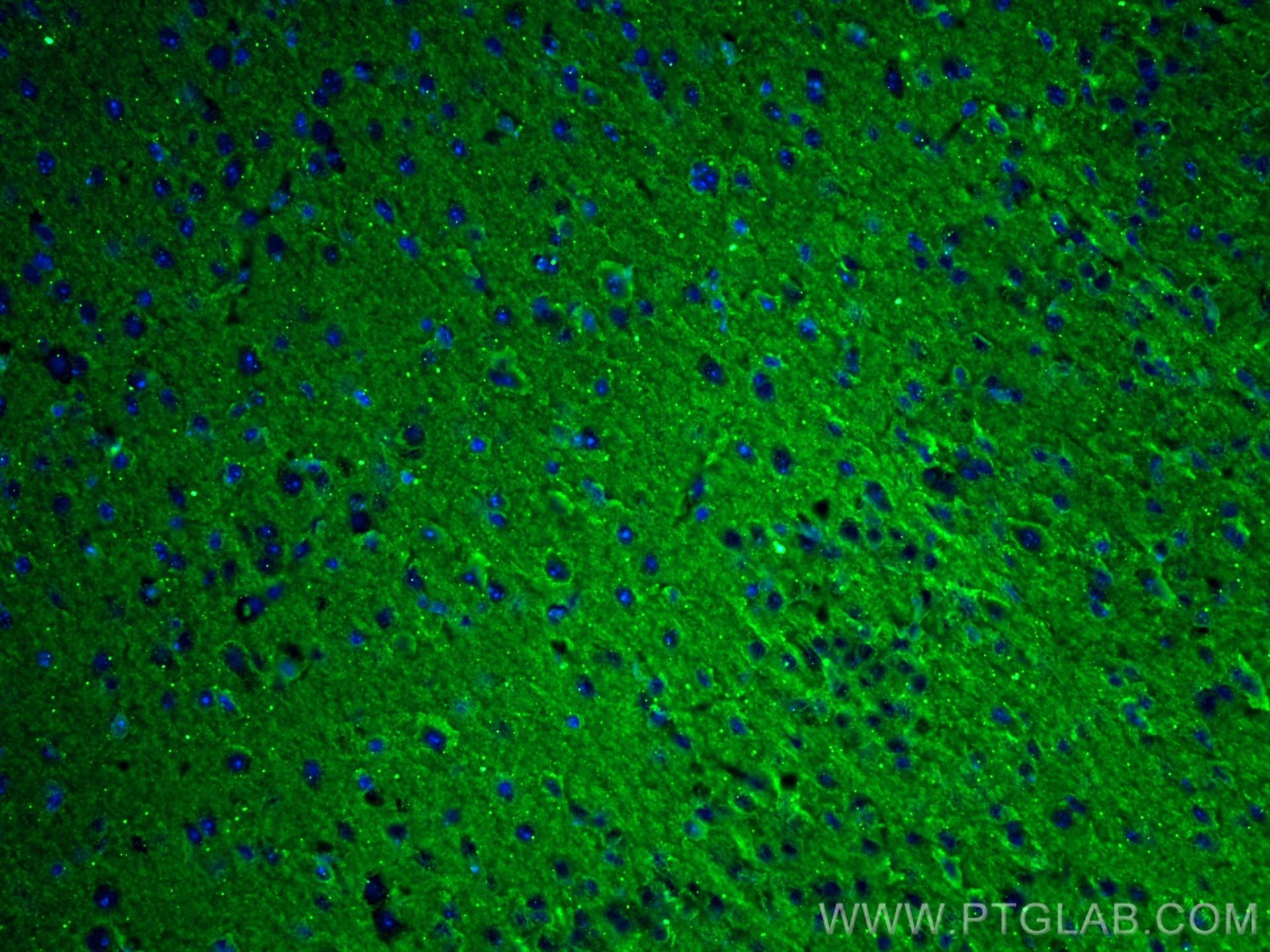 Immunofluorescence (IF) / fluorescent staining of mouse brain tissue using P2RY1 Monoclonal antibody (67654-1-Ig)