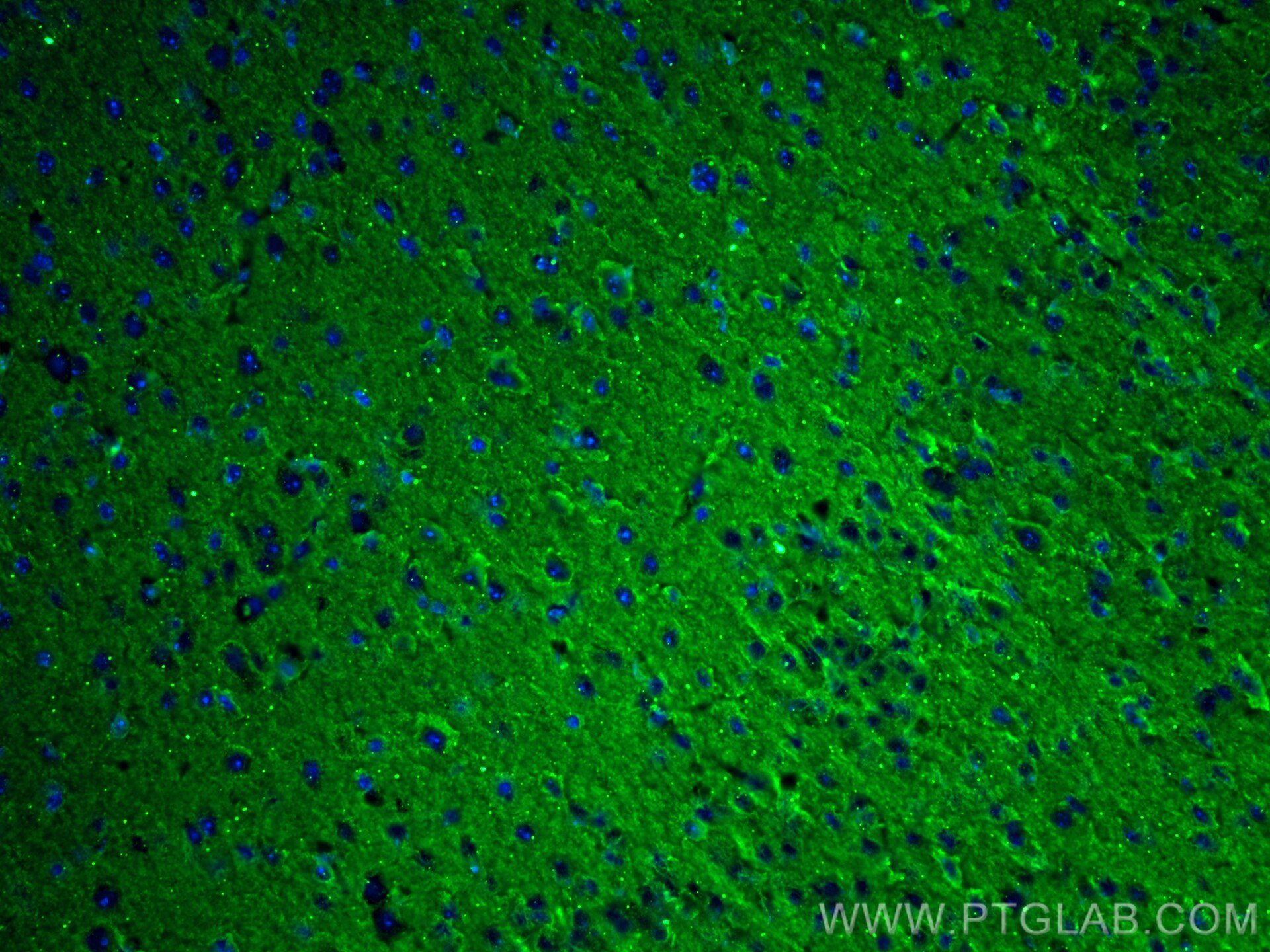 IF Staining of mouse brain using 67654-1-Ig