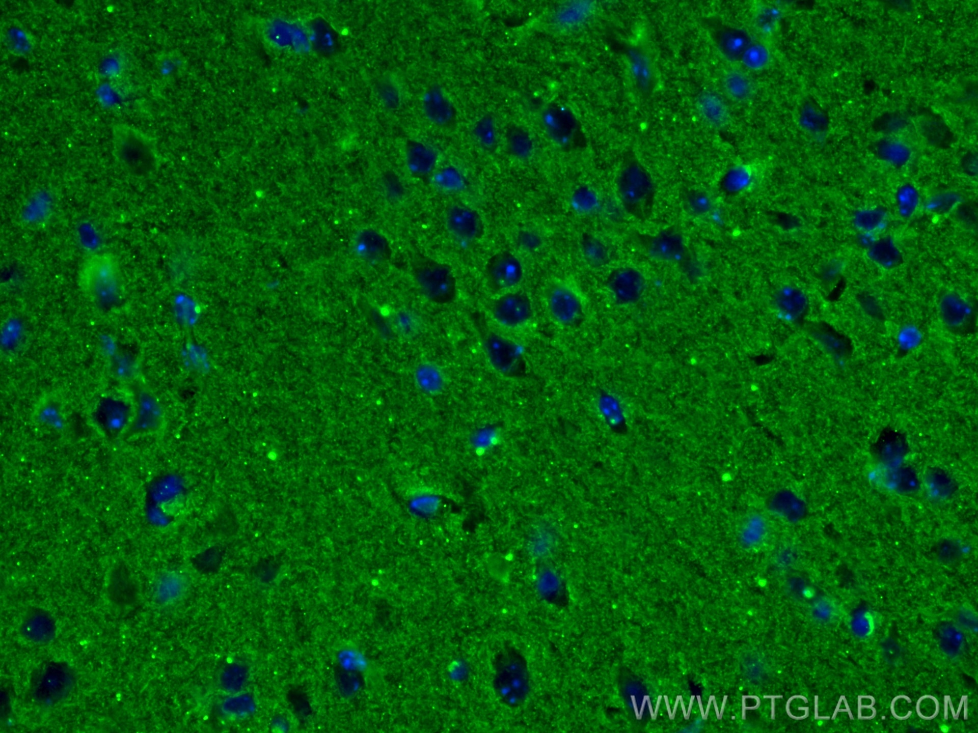 IF Staining of mouse brain using 67654-1-Ig