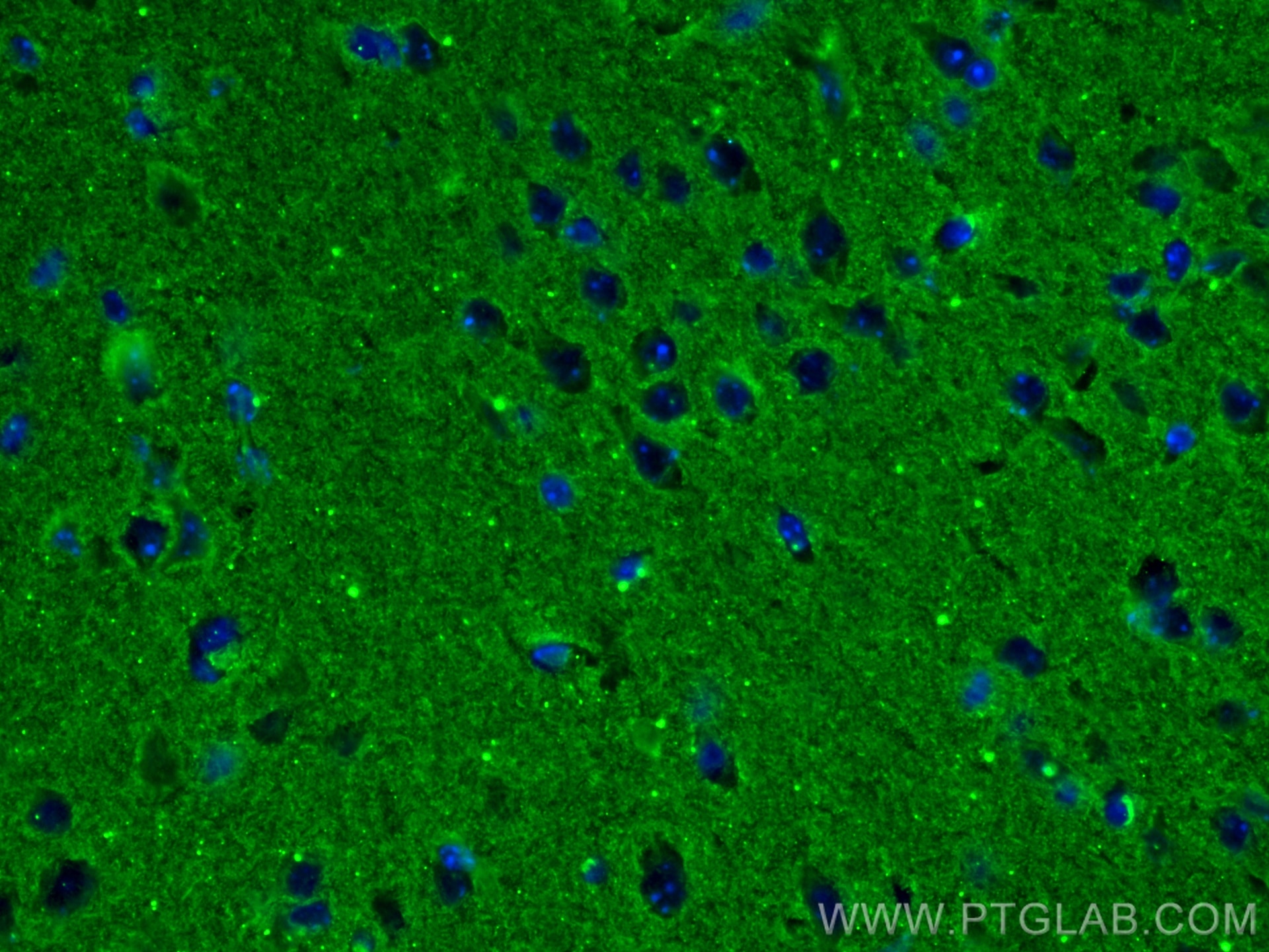 Immunofluorescence (IF) / fluorescent staining of mouse brain tissue using P2RY1 Monoclonal antibody (67654-1-Ig)