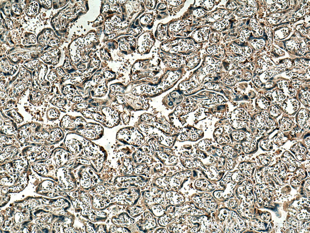 Immunohistochemistry (IHC) staining of human placenta tissue using P2RY1 Monoclonal antibody (67654-1-Ig)