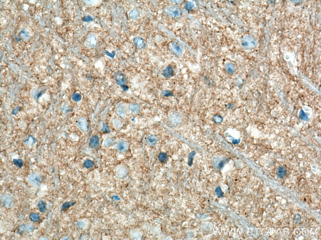 Immunohistochemistry (IHC) staining of mouse brain tissue using P2RY1 Monoclonal antibody (67654-1-Ig)
