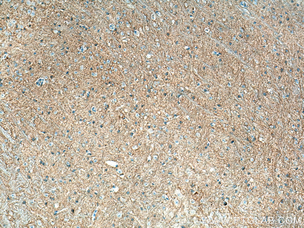 Immunohistochemistry (IHC) staining of mouse brain tissue using P2RY1 Monoclonal antibody (67654-1-Ig)