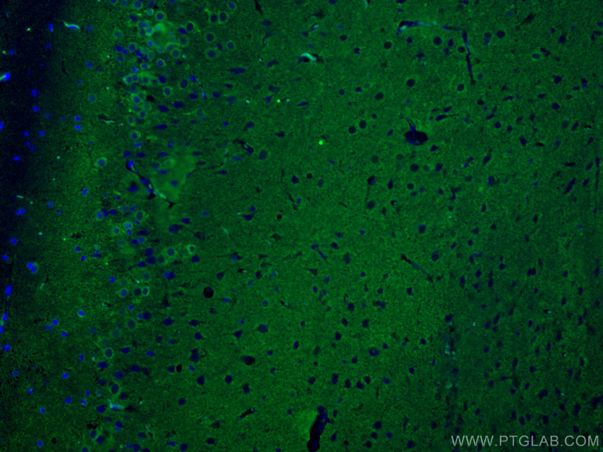 Immunofluorescence (IF) / fluorescent staining of mouse brain tissue using CoraLite® Plus 488-conjugated P2RY1 Monoclonal ant (CL488-67654)