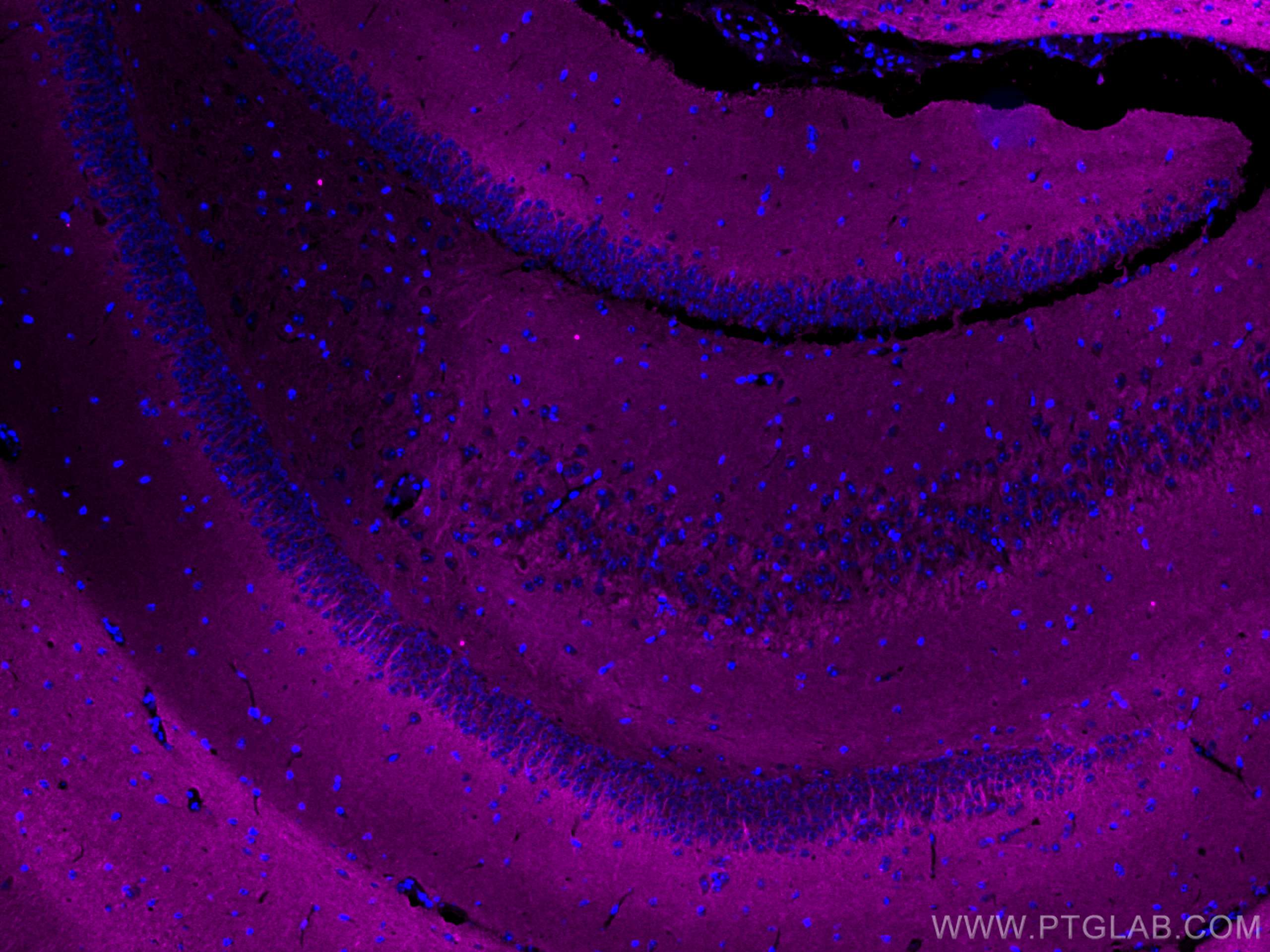 Immunofluorescence (IF) / fluorescent staining of mouse brain tissue using CoraLite® Plus 647-conjugated P2RY1 Monoclonal ant (CL647-67654)