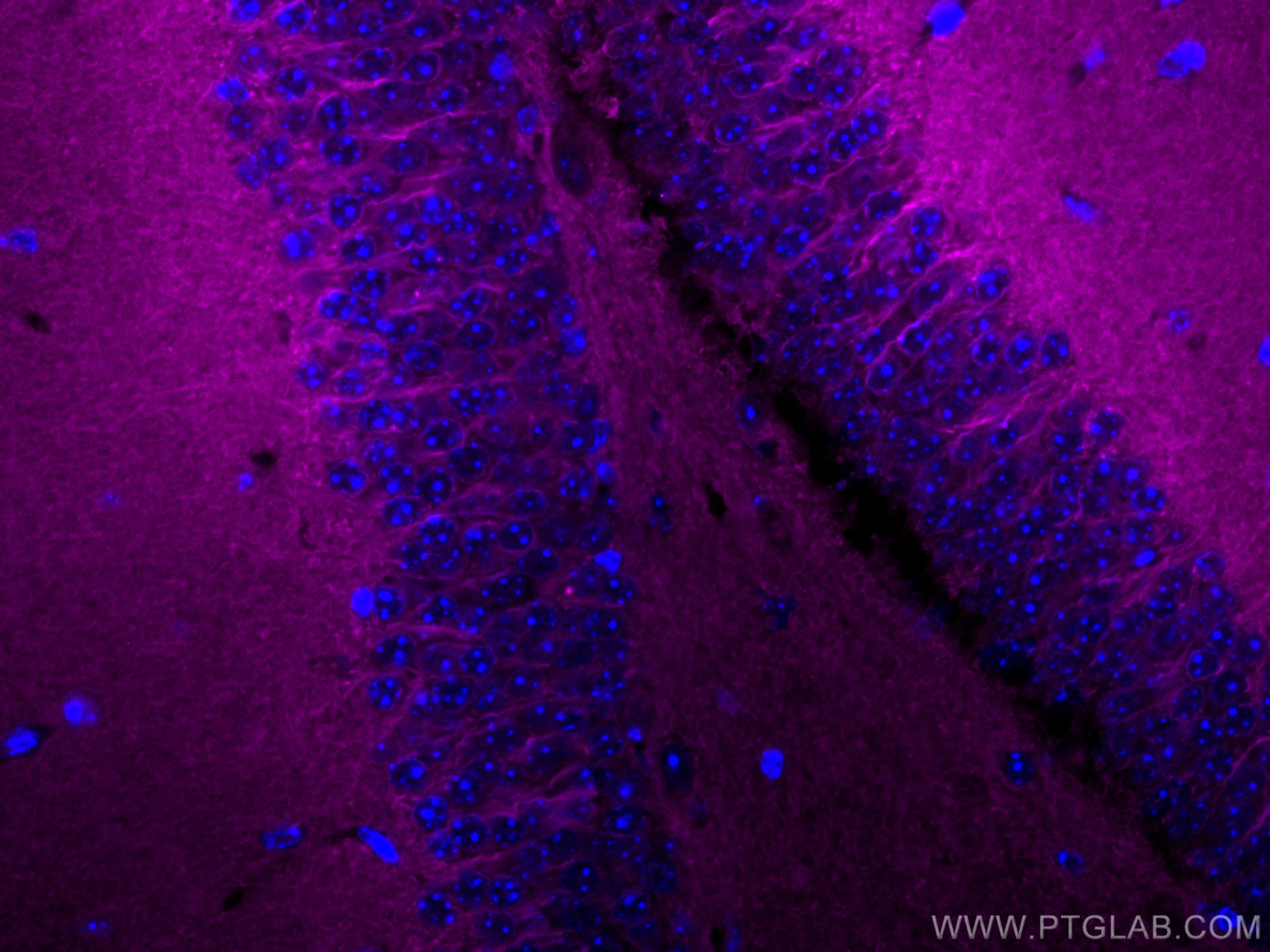 IF Staining of mouse brain using CL647-67654