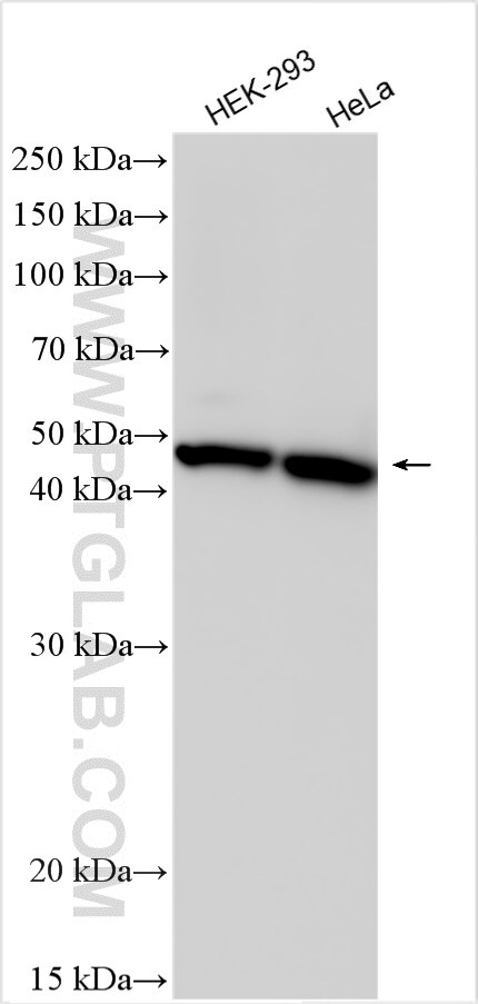 Western Blot (WB) analysis of various lysates using P2RY11 Polyclonal antibody (20191-1-AP)