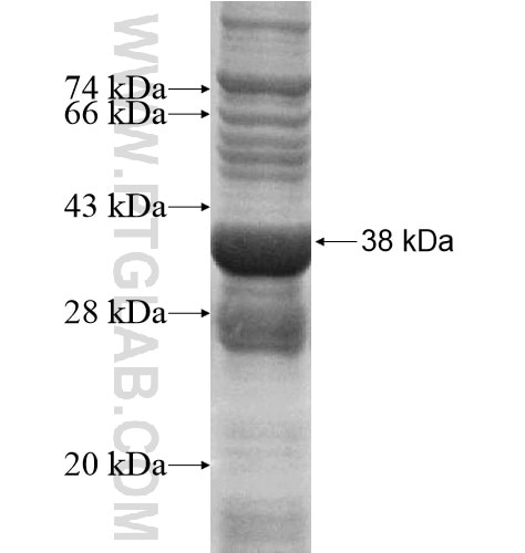 P2RY11 fusion protein Ag14106 SDS-PAGE