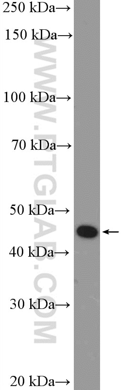 Western Blot (WB) analysis of mouse spinal cord tissue using P2RY12 Polyclonal antibody (11976-1-AP)