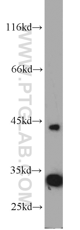 Western Blot (WB) analysis of human adrenal gland tissue using P2RY12 Polyclonal antibody (11976-1-AP)