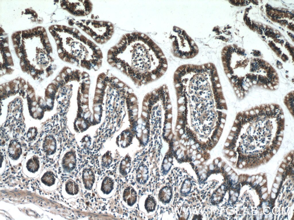 Immunohistochemistry (IHC) staining of human small intestine tissue using P2RY13 Polyclonal antibody (20335-1-AP)