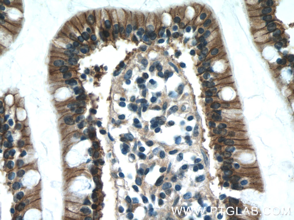 Immunohistochemistry (IHC) staining of human small intestine tissue using P2RY13 Polyclonal antibody (20335-1-AP)