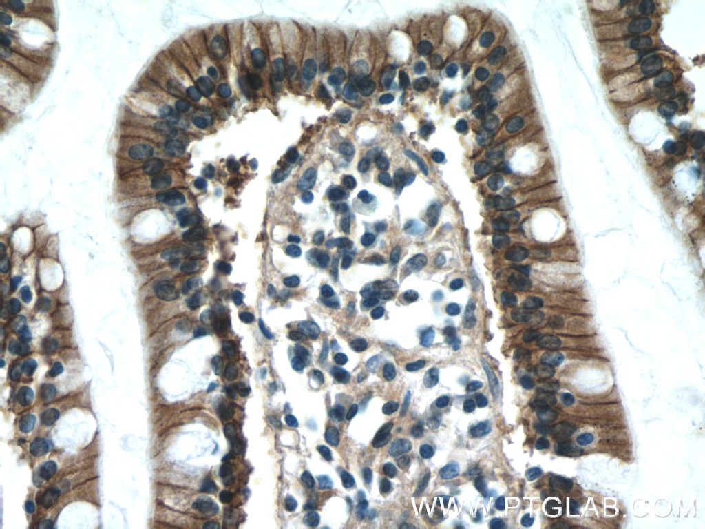 IHC staining of human small intestine using 20335-1-AP