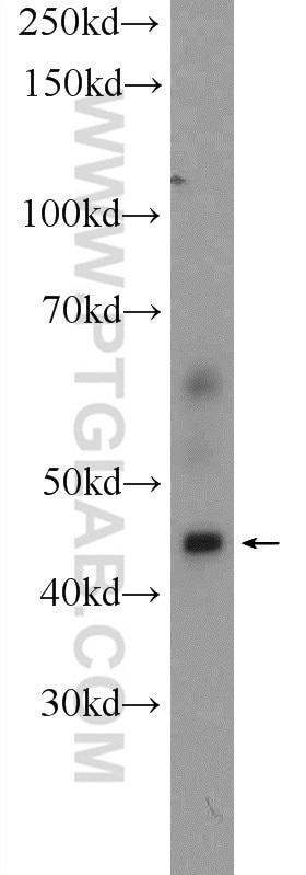 Western Blot (WB) analysis of HeLa cells using P2RY13 Polyclonal antibody (20335-1-AP)