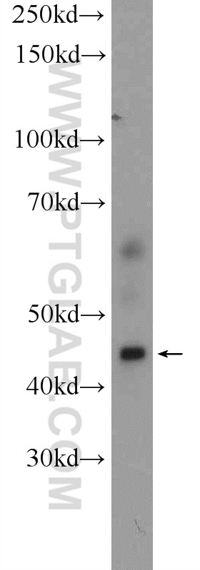 WB analysis of HeLa using 20335-1-AP