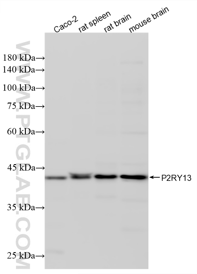 Western Blot (WB) analysis of various lysates using P2RY13 Recombinant monoclonal antibody (83975-3-RR)