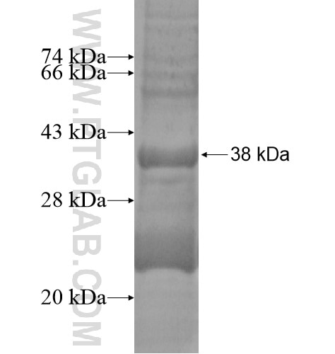 P2RY2 fusion protein Ag14107 SDS-PAGE