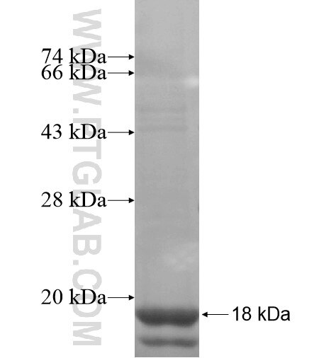 P2RY2 fusion protein Ag14499 SDS-PAGE