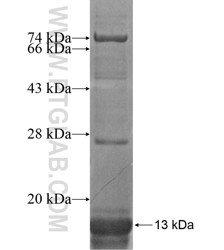 P2RY4 fusion protein Ag16751 SDS-PAGE