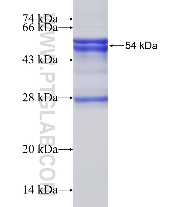 P2RY6 fusion protein Ag1820 SDS-PAGE