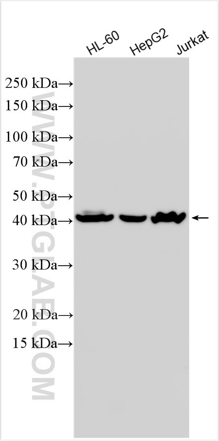 Western Blot (WB) analysis of various lysates using P2RY8 Polyclonal antibody (17569-1-AP)
