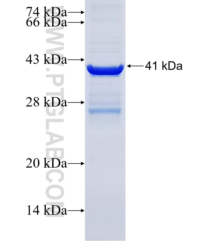 P2RY8 fusion protein Ag11775 SDS-PAGE