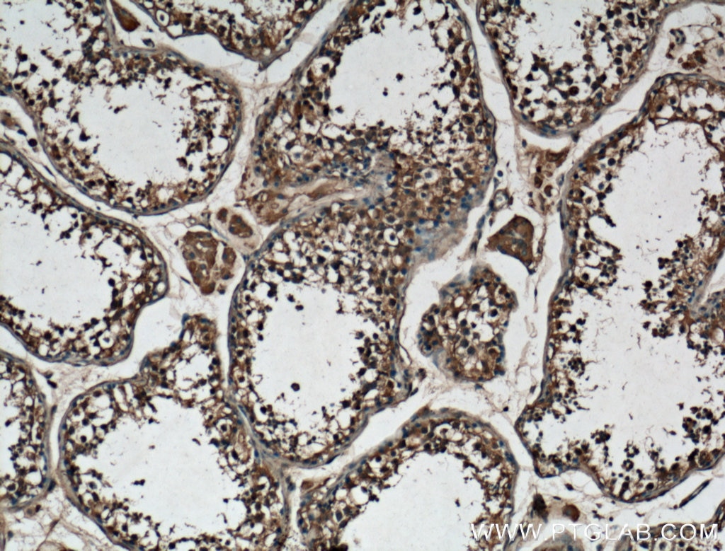 Immunohistochemistry (IHC) staining of human testis tissue using P3H1 Polyclonal antibody (26691-1-AP)