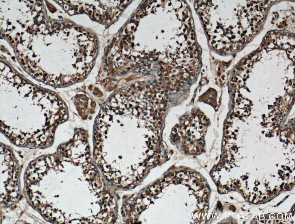 IHC staining of human testis using 26691-1-AP