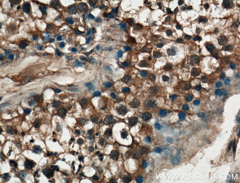 Immunohistochemistry (IHC) staining of human testis tissue using P3H1 Polyclonal antibody (26691-1-AP)