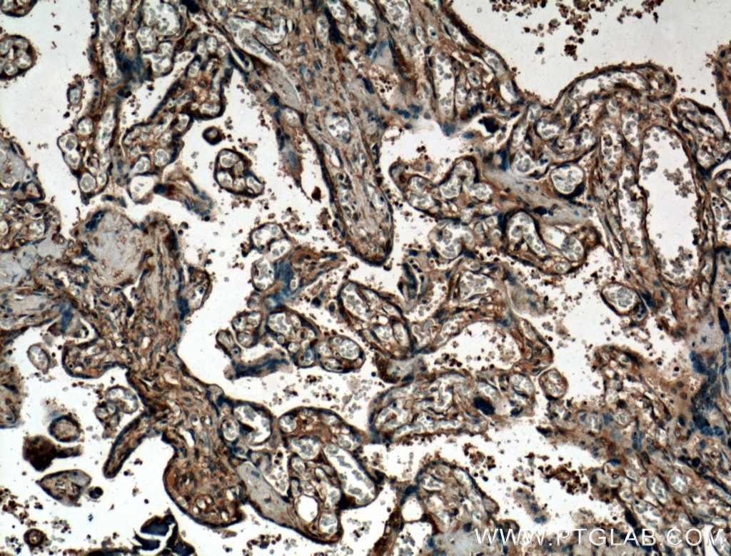 IHC staining of human placenta using 26691-1-AP