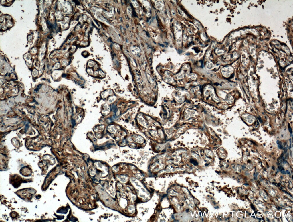 IHC staining of human placenta using 26691-1-AP