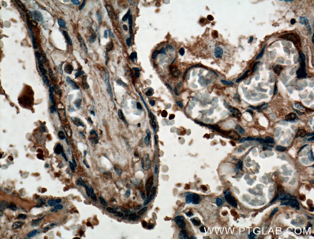 Immunohistochemistry (IHC) staining of human placenta tissue using P3H1 Polyclonal antibody (26691-1-AP)